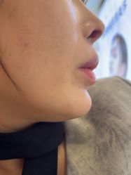 -长沙雅美医疗美容医院