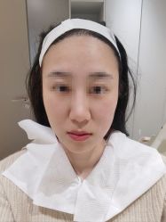 体验后-BR光电保养