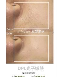 -E.beauty驻颜·痘敏肌调理中心