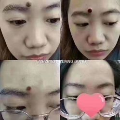 -美人痣全国连锁