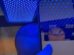 -碧莲盛·不剃发植发