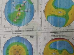 -昆明爱尔眼科医院