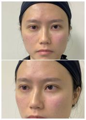 -广州健丽·去眼袋医疗美容机构
