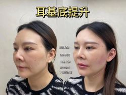 -素美医疗美容·西南眼鼻整形·修复基地