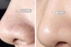 -美肤盾祛痘·问题肌头疗管理中心