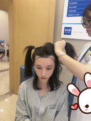 -大麦微针植发丨全国连锁