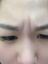 -More摩尔医美の注射线雕光电中心