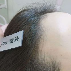 -谜秀韩式半永久纹眉纹绣洗眉