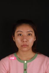 -北京米扬丽格医疗美容·联合丽格鼻整形中心