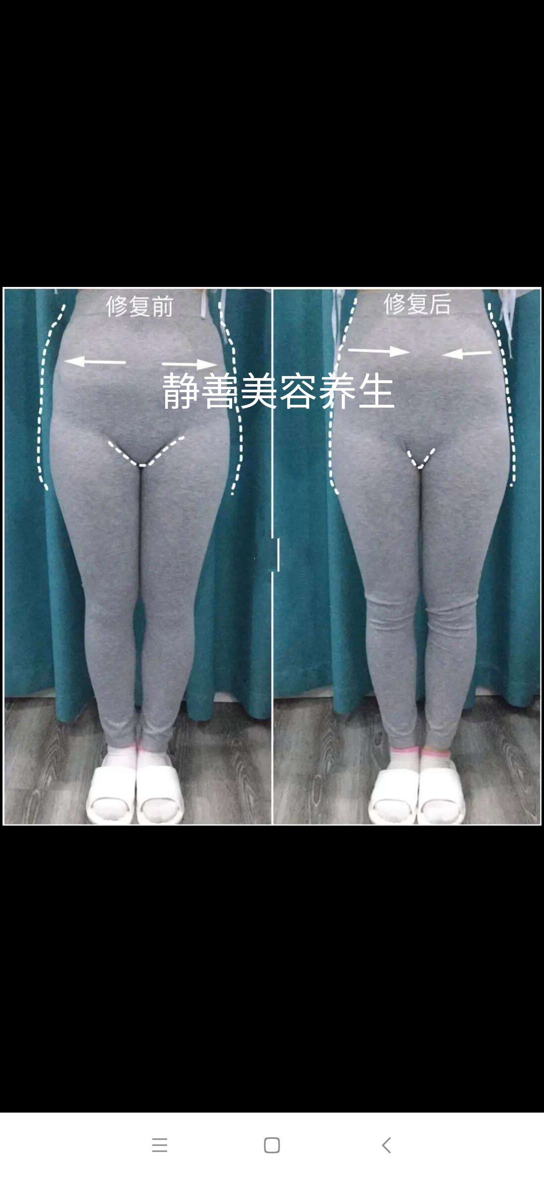 骨盆修复美容院大概多少钱一次(骨盆修复美容院大概多少钱一次啊)
