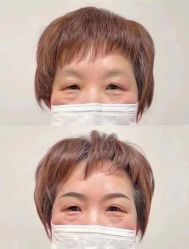 -郡艺医疗美容·微整·眼鼻吸脂