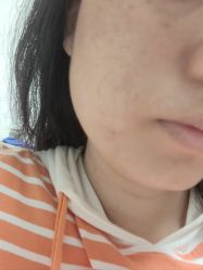 体验后-广州美莱医疗美容医院