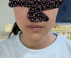 体验前-上海玫瑰医疗美容医院