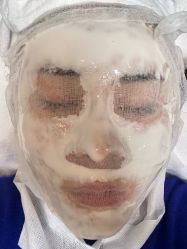 -蚌埠国色医疗美容医院•眼鼻整形