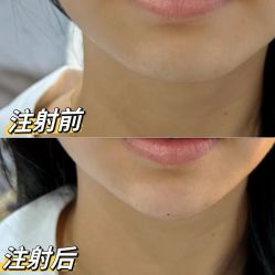 -上海伊莱美医疗美容医院