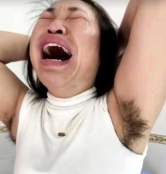 -薇兰专业脱毛连锁机构