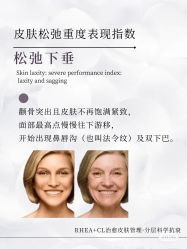 -安吉拉青春化管理中心