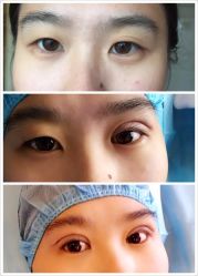 -尚玲纹绣纹眉特价店