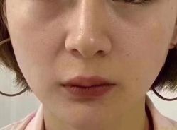 -天津健丽·去眼袋医疗美容机构