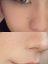 -深圳柏颜医疗美容诊所