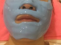 -成都苗方清颜专业祛痘