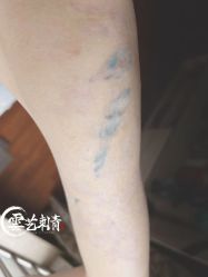 -雲艺刺青·洗纹身