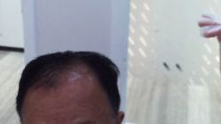 -雍禾植发全国连锁