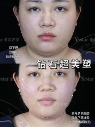 -Yestar重庆艺星医疗美容医院