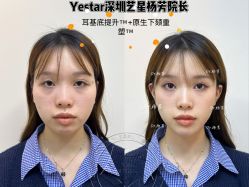 -深圳艺星医疗美容医院