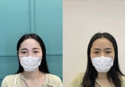 -杨益美学·野生眉半永久纹眉发际线