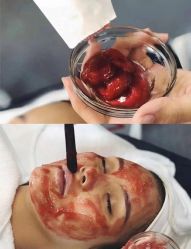 -美肤盾祛痘·问题肌头疗管理中心