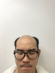 -发饰美男士增发补发假发定制店