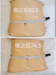 -Lily纤美·科技减脂中心