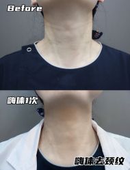 -铂诗玥医美
