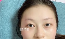 -MISS STAR·半永久纹眉·发际线·美瞳线