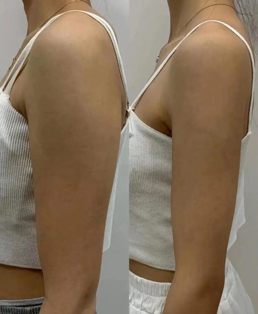 get同款纤细手臂