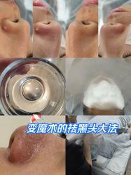 -skin79皮肤管理中心