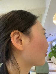 -长沙雅美医疗美容医院