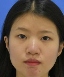 -天津健丽·去眼袋医疗美容机构