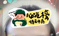 -大麦微针植发全国连锁