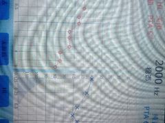 -北京悦听品牌助听器集合店峰力奥迪康斯达克瑞声达(石景山店)