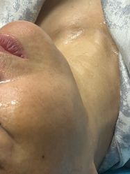 -长沙雅美医疗美容医院