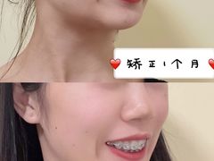 -极光口腔·矫正种植修复(锦江店)