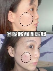 -安徽合肥韩美整形外科医院