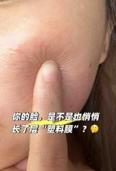 点击看大图 -MLP美丽派·问题肌疗愈中心