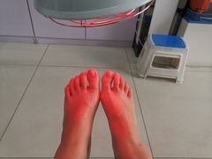 -世龙世家甲沟炎·灰指甲·嵌甲矫正·修脚(武侯区双楠店)