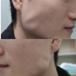 -弘美医美·艾维岚童颜抗衰中心
