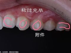 -团圆口腔·种植中心(锦江院区)
