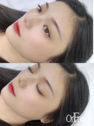 点击看大图 -OnFaer.纹眉半永久无创洗眉