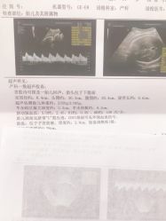 点击看大图 -潍坊艾玛妇产医院